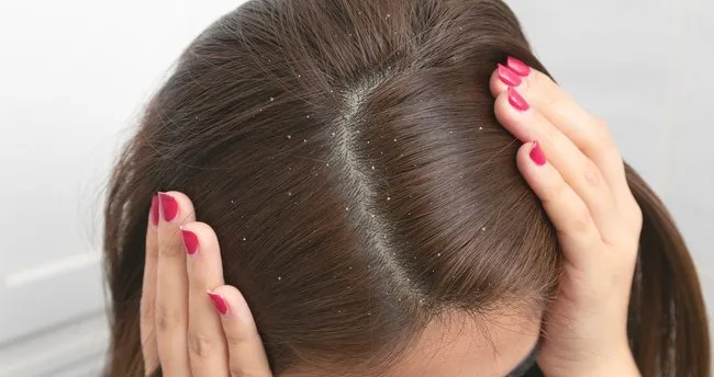 bitkisel cozumler ile kepek