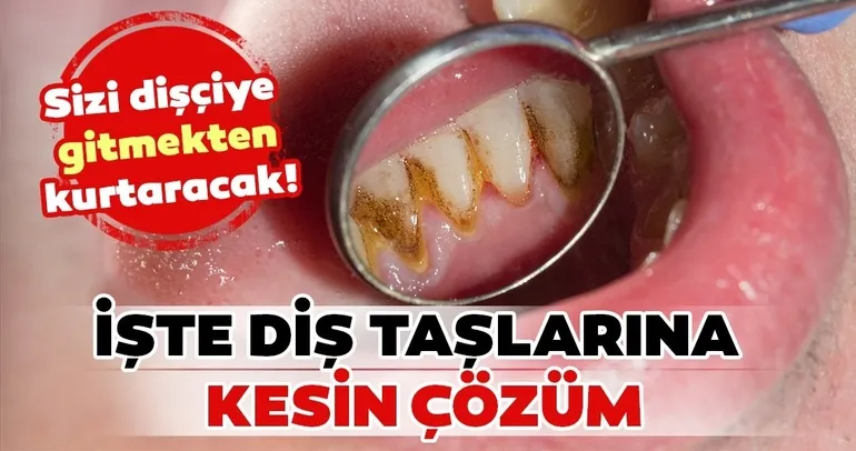 Diş taşından kurtulmanın yolları