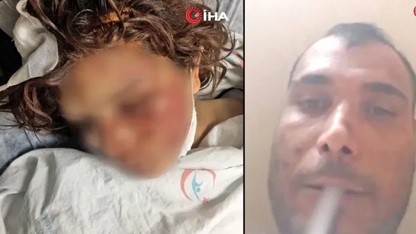 Son dakika haberi... Şanlıurfa'daki dehşetin görüntüleri ortaya çıktı! İşkenceci cani koca eşini...  | Video