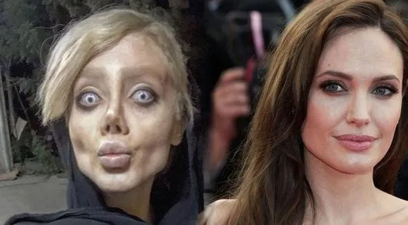 Angelina Jolie olmak istedi son hali korkunç!