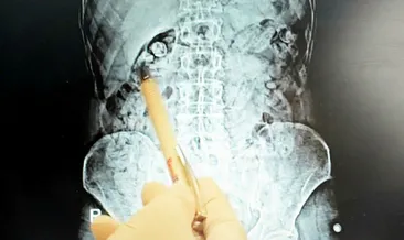 Uyuşturucuyu midelerinde saklamışlar