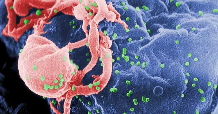 Bu virüs 12 ile 18 ayda öldürüyor