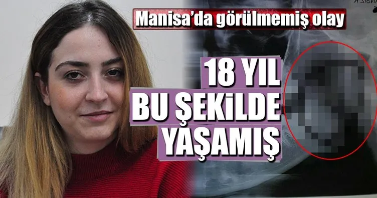 18 yıl bu şekilde yaşamış