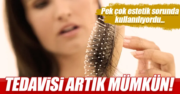 Saç dökülmesinin tedavisi artık mümkün!