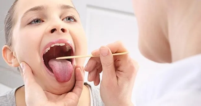 Bademcik Şişmesine Ne İyi Gelir? Bademcik Şişmesi Nasıl Geçer, Bitkisel Yöntemlerle En Hızlı Nasıl İyileşir?