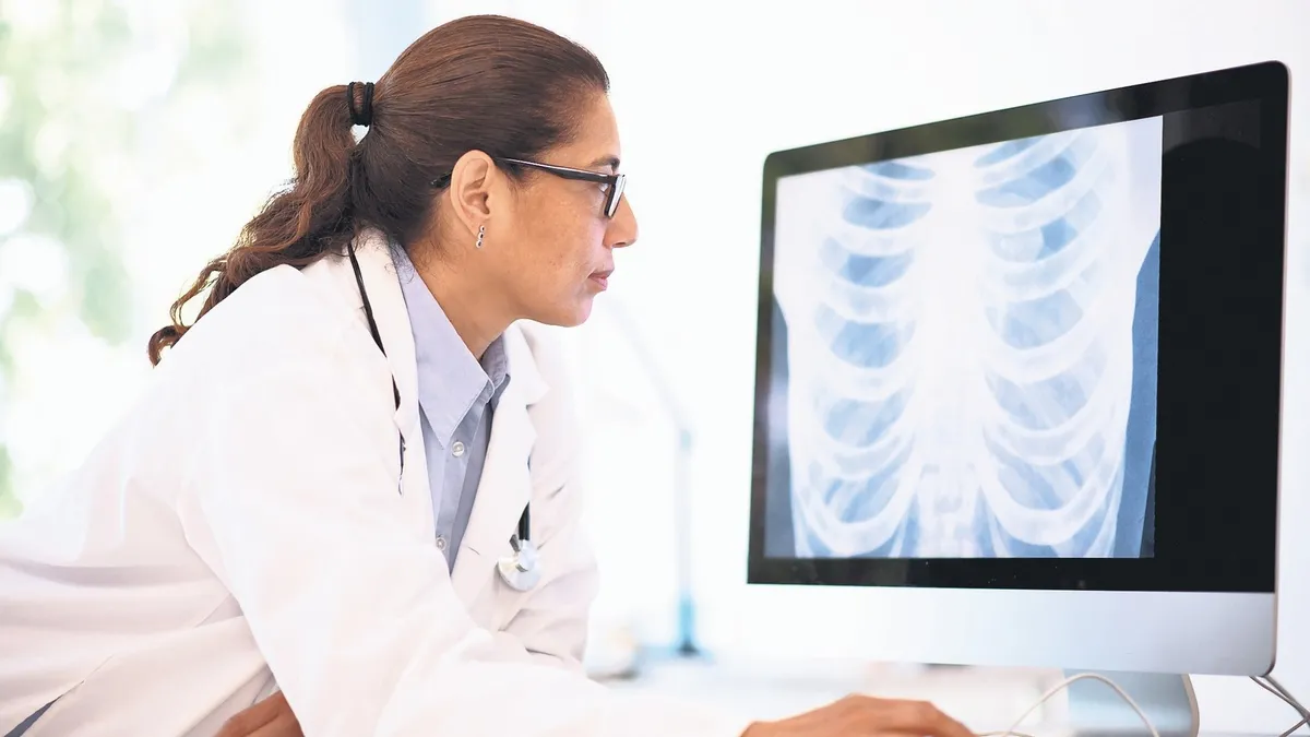 Akciğer kanseri kadınlarda artıyor – Sağlık Haberleri Akciğer kanseri kadınlarda artıyor – Sağlık Haberleri