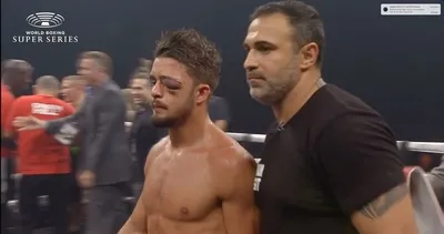 Sol gözünü kaybedecekti ama maça devam etmek istedi!