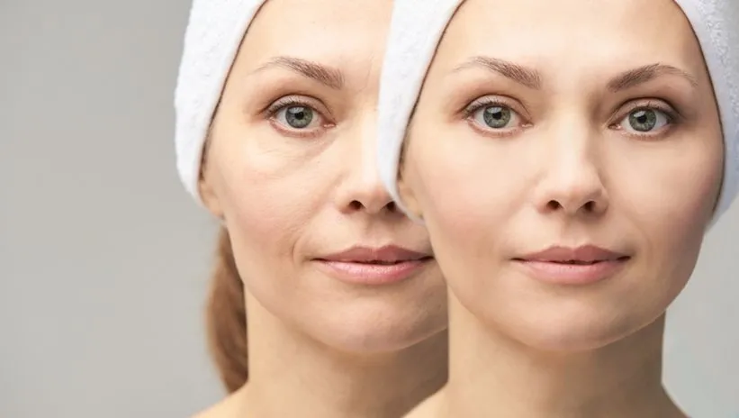 Adeta yaşlanmayı durduruyor! Botoks etkisi yaratan maske tarifi