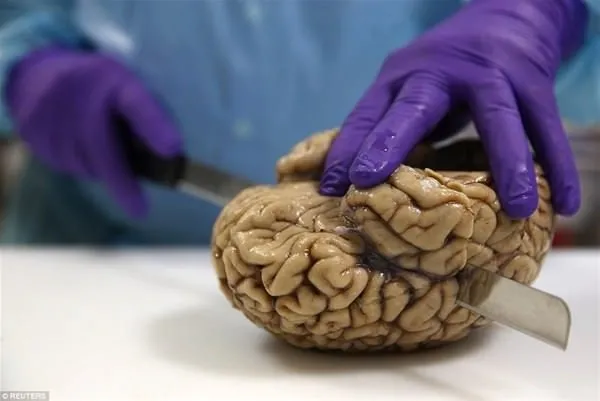 Burası bir beyin bankası!