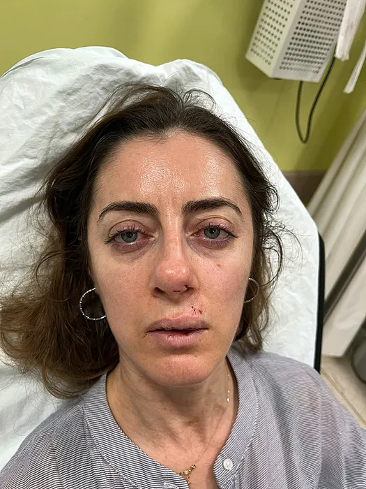 SON DAKİKA... Eşinin sevgilisi sandığı kadını öldüresiye darp etti: Ağzımdan burnumdan kan gelmeye başladı…