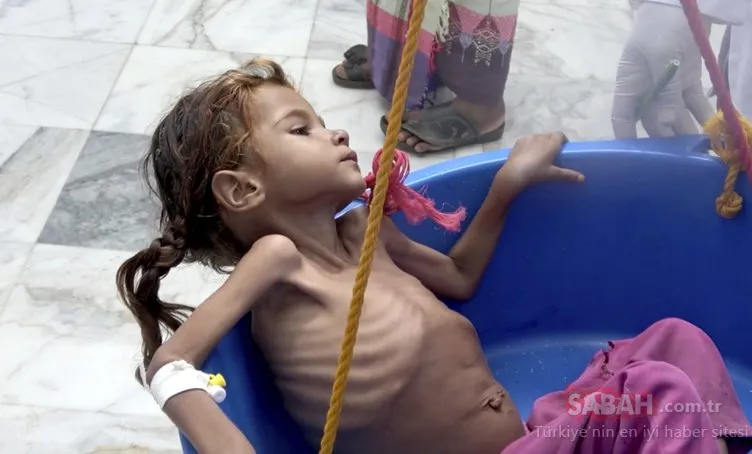 Yemen’de her 10 dakikada bir çocuk...