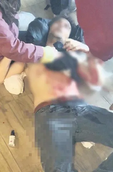 Dönem ödevi kavgası kanlı bitti