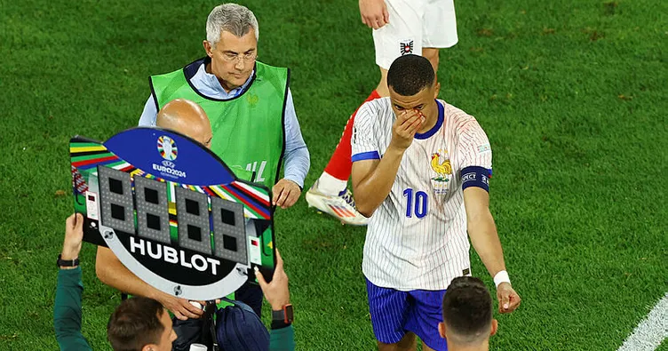 Fransa’da şok! Kylian Mbappe’nin burnu kırıldı