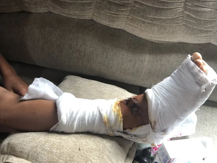 Pitbull 13 yaşındaki çocuğa saldırdı! Bıraksalar beni yiyecekti