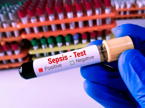 tehlike-yayiliyor-bu-virus-anneden-bebege-geciyor-1726139782502.jpg