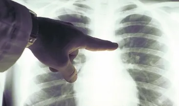 Akciğer kanserinde umut veren ilaç