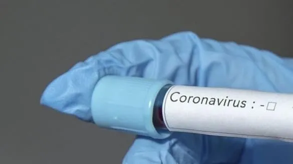 Son dakika haberi! Koronavirüs ile ilgili sevindiren haber geldi! İşte corona virüsü ile ilgili COVİD-19 dikkat çeken detay...