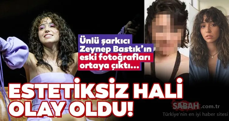 Herkes ünlü şarkıcı Zeynep Bastık’ın eski halini konuşuyor... Zeynep Bastık’ın estetiksiz hali sosyal medyada olay oldu!