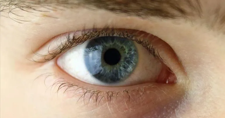 Göz renginiz hastalığınızı belirliyor