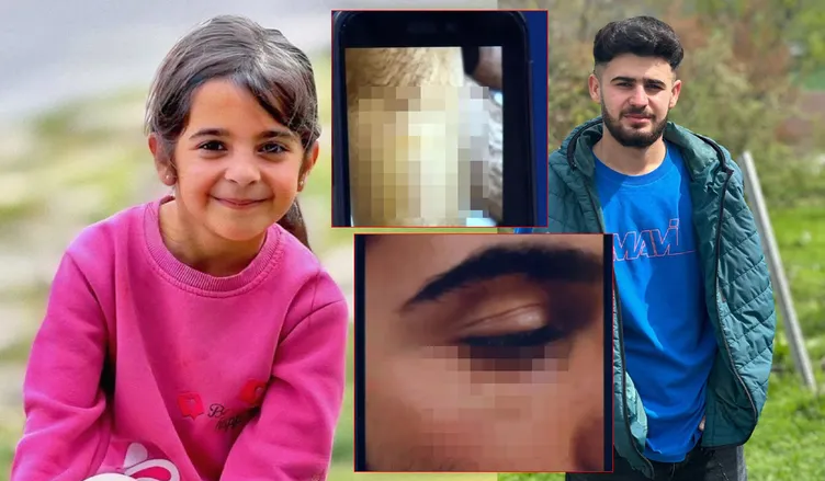SON DAKİKA! Narin Güran cinayetini aydınlatacak görüntü: İşte Enes Güran’ın kolundaki ısırık izi ve yüzündeki morluk!