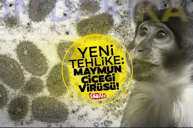 Flaş! Maymun çiçeği virüsü nedir, Türkiye’de var mı, belirtileri nelerdir, nasıl bulaşır? Maymun çiçeği virüsü için yeni pandemi şüphesi!
