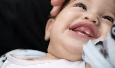 Diş çıkarma süreci bebekten bebeğe değişebilir