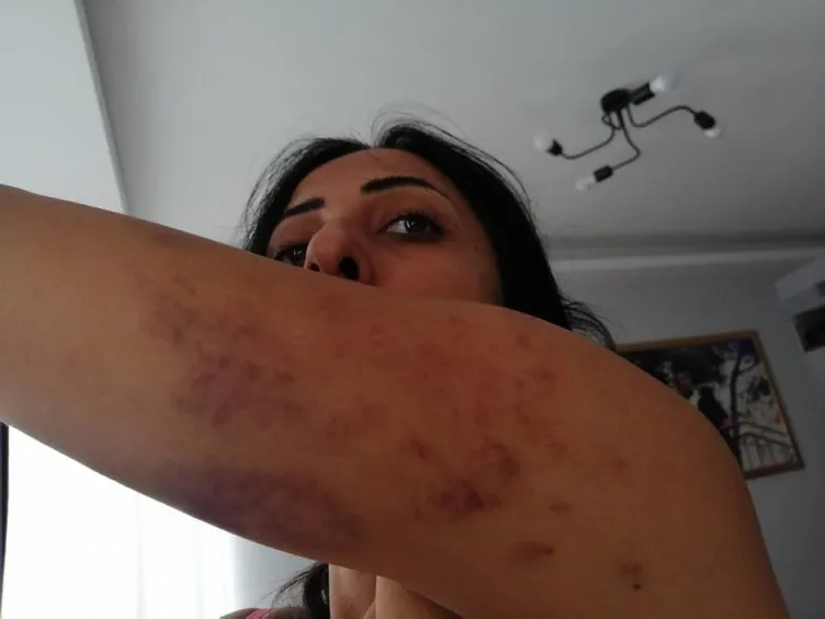 Annesi para karşılığında sattı: Kocası şiddet uyguladı! Acıların kadını Saime’nin hikayesi ağlattı!