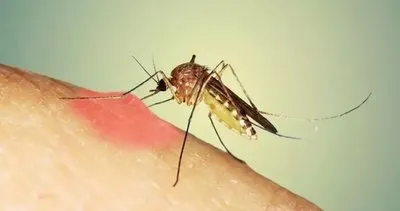Sivrisinek ısırıklarına anında derman oluyor! İşte derin bir nefes almanıza yardımcı olacak tek malzeme