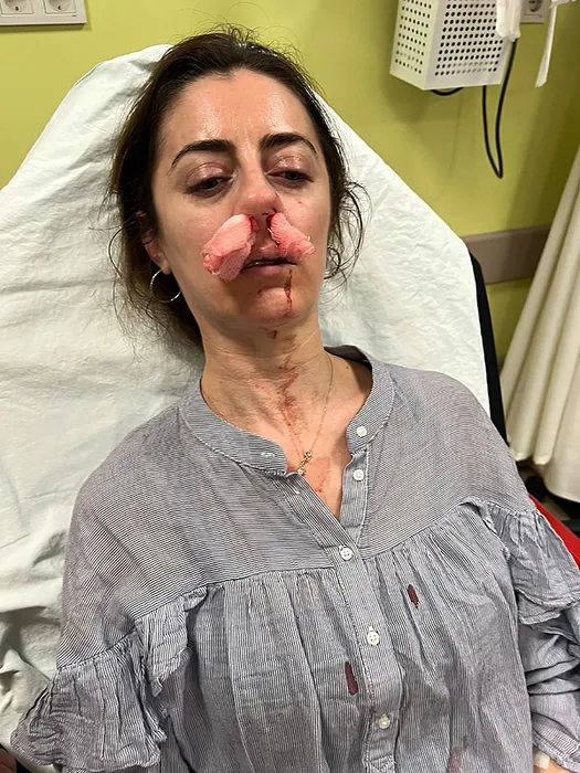 SON DAKİKA... Eşinin sevgilisi sandığı kadını öldüresiye darp etti: Ağzımdan burnumdan kan gelmeye başladı…
