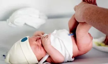 Göbek bağı bakımı