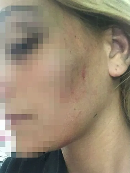 İzmir’de üniversite hocası, öğrencisi olan eski sevgilisine şiddet uyguladığı iddiasıyla yargılanacak