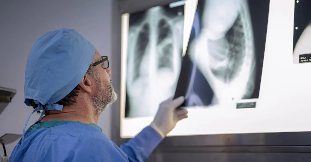 rontgende belli olmuyor en sik ayakta