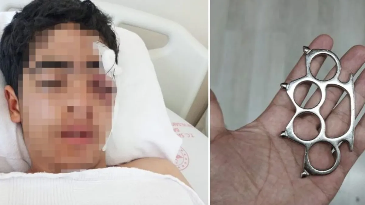 Esenyurt’ta akran şiddeti hastanelik etti! 15 yaşındaki Bünyamin muştalı saldırıya uğradı! Esenyurt’ta akran şiddeti hastanelik etti! 15 yaşındaki Bünyamin muştalı saldırıya uğradı!