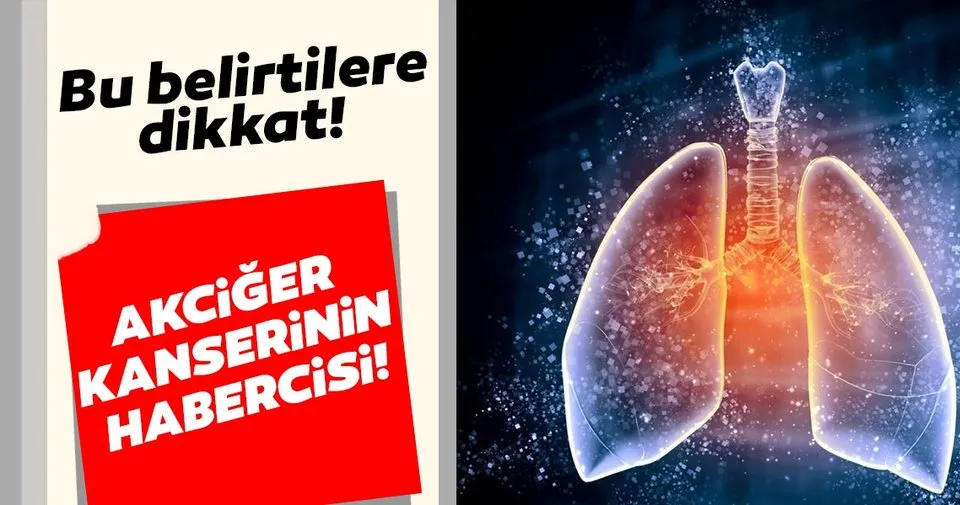 akciger kanseri belirtileri saglik