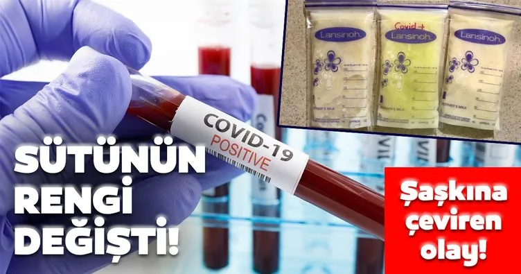 Meksika’da şaşkına çeviren olay! Koronavirüse yakalanan annenin sütünün rengi değişti!