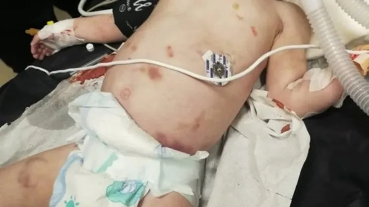 Son dakika haberi... Hayat bebeğe işkence iddiası! Anne ve babası gözaltına alındı! | Video