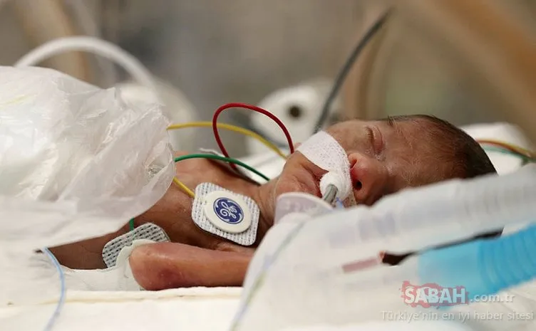 Coronavirüste ezber bozan son dakika gelişmesi! Dünyada bebek ve çocuk ölümleri başladı