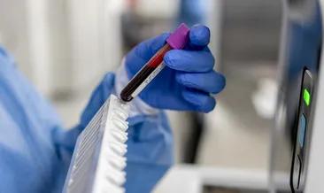 Kanserde hayat kurtaran tedavi!