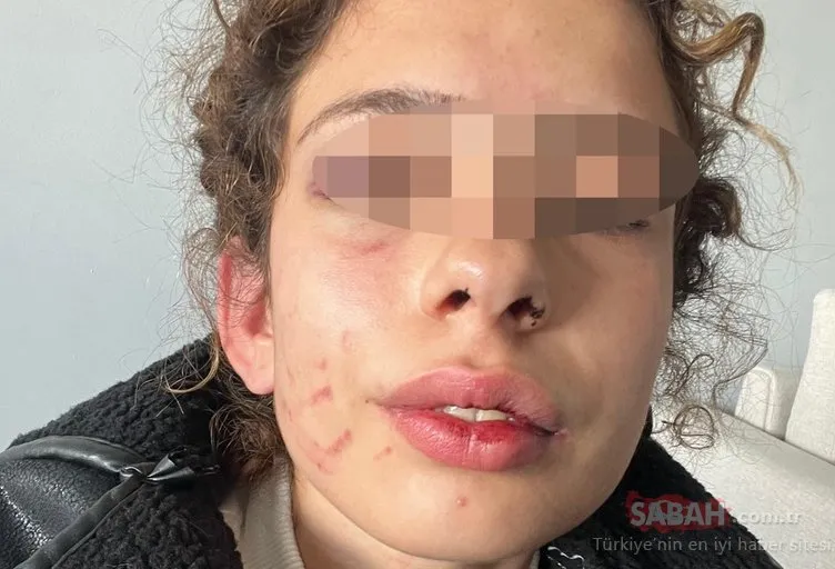 SON DAKİKA | Konya’da saplantılı sevgili dehşeti yaşattı! Talihsiz genç kız: Korkudan yurduma gidemiyorum