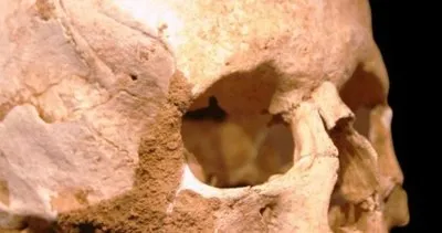 İstanbul’daki ilk Afrikalının kafatası Bathonea kazılarında bulundu