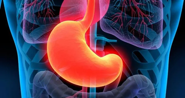 Gastrit nedir, sebepleri nelerdir, tedavi edilir mi?