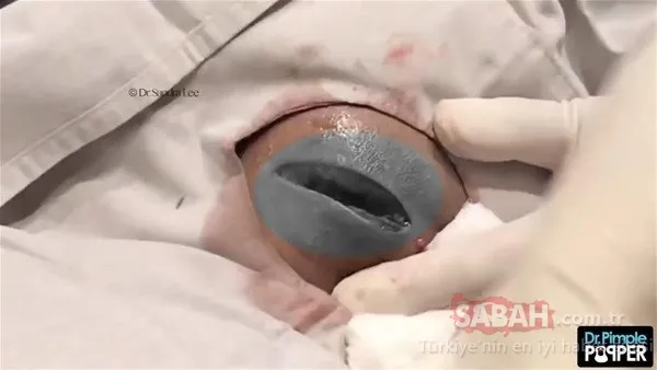 Doktora bu halde geldi! Sonrasındaysa...