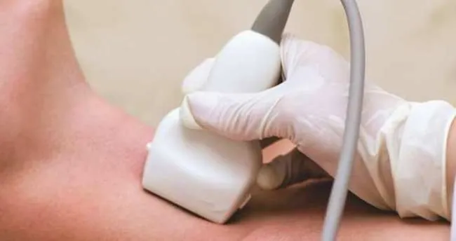 Guatr Belirtileri Nelerdir? Guatr Belirtileri Nasıl Anlaşılır ve Semptomları Neler?