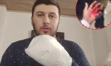 Antalya’da döner bıçaklı saldırı! Sipariş almaya gitti dehşeti yaşadı: 'Avuç içimi ikiye bölüp...' #antalya