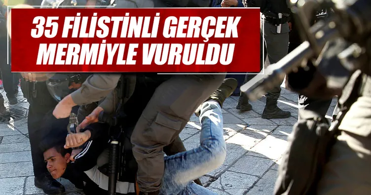 35 Filistinli gerçek mermiyle vuruldu