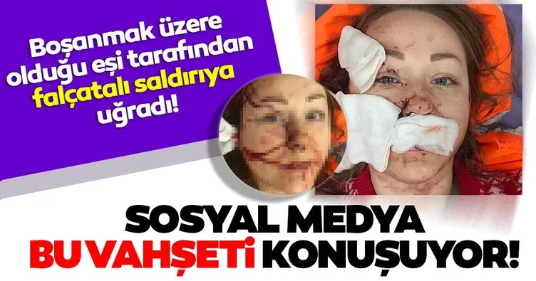 Son Dakika Haberi: Kocaeli’nde yaşayan Ukraynalı Anna Butim’e eski eşi Mesut Öztürkmen tarafından falçatalı saldırı iddiası