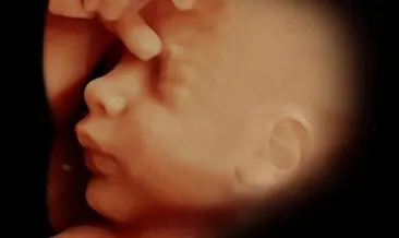 gebelikte detayli ultrason nasil