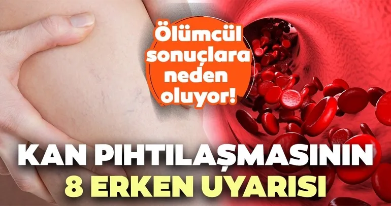 Ölümcül sonuçlara sebep oluyor! İşte kan pıhtılaşmasının 8 erken uyarısı