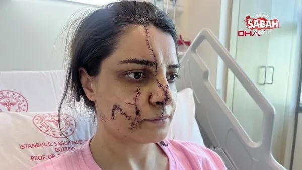 Marmaray İstasyonu'nda saldırıya uğrayan kadın yüzündeki 40 dikişle dehşet dolu anları anlattı | Video