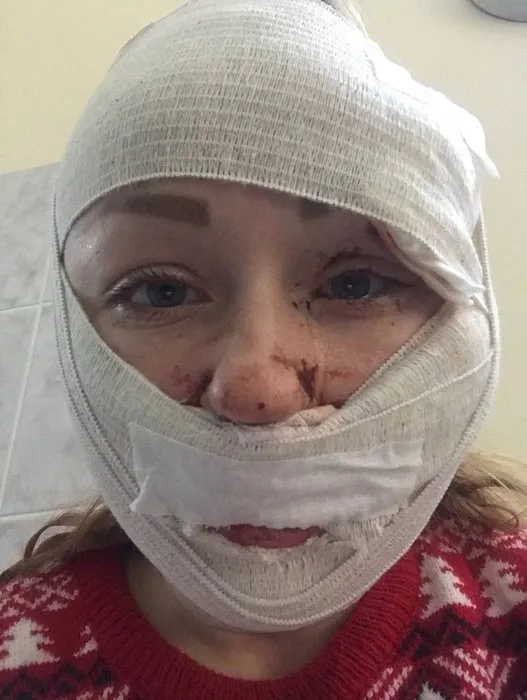 Ukraynalı Anna Butim’i falçatayla yaralamıştı: Cani koca hakkında istenen ceza belli oldu!